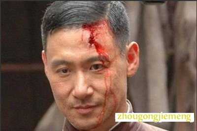 梦见头被人打的流血