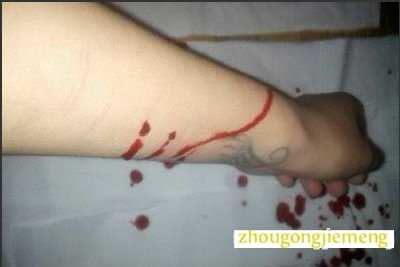 梦见胳膊流血